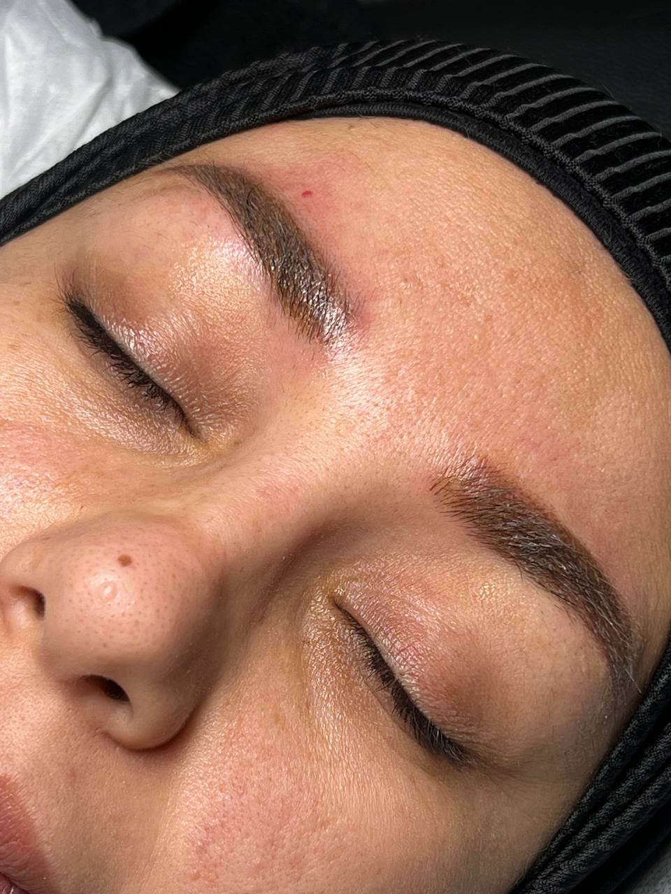 دورة ميكروبغمنتايشن الحواجب